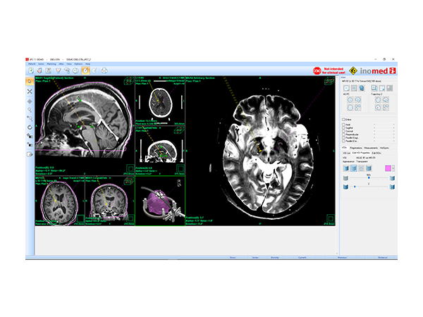 iPS Trial Licence gültig für 3 Monate iPS Trial Licence gültig für 3 Monate